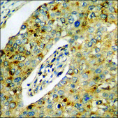 Anti-phospho-CK-1 &#945; (pTyr294) antibody produced in rabbit affinity isolated antibody