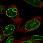 Anti-LBR antibody produced in rabbit Prestige Antibodies&#174; Powered by Atlas Antibodies, affinity isolated antibody