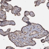 Anti-MGLL antibody produced in rabbit Prestige Antibodies&#174; Powered by Atlas Antibodies, affinity isolated antibody, buffered aqueous glycerol solution