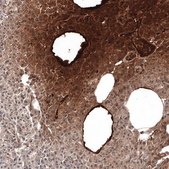 Monoclonal Anti-SAA1 antibody produced in mouse Prestige Antibodies&#174; Powered by Atlas Antibodies, clone CL9175, purified immunoglobulin, buffered aqueous glycerol solution