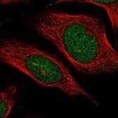 Anti-VWA5A antibody produced in rabbit Prestige Antibodies&#174; Powered by Atlas Antibodies, affinity isolated antibody, buffered aqueous glycerol solution