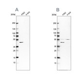 Anti-GLUL antibody produced in rabbit Ab1, Prestige Antibodies&#174; Powered by Atlas Antibodies, affinity isolated antibody, buffered aqueous glycerol solution