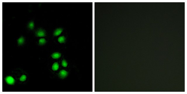 Anti-EXO1 antibody produced in rabbit affinity isolated antibody