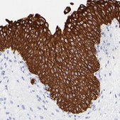 Anti-KRT19 antibody produced in rabbit Prestige Antibodies&#174; Powered by Atlas Antibodies, affinity isolated antibody, buffered aqueous glycerol solution
