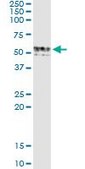 Monoclonal Anti-GIF, (C-terminal) antibody produced in mouse clone 1D9, purified immunoglobulin, buffered aqueous solution