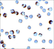 Anti-TFF3 antibody produced in rabbit affinity isolated antibody, buffered aqueous solution