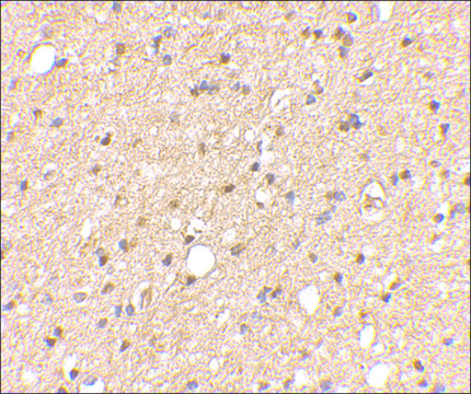 Anti-LGI2 (ab2) antibody produced in rabbit affinity isolated antibody, buffered aqueous solution