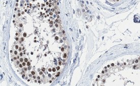 Anti-METTL14 Antibody, clone 2G22 ZooMAb&#174; Rabbit Monoclonal recombinant, expressed in HEK 293 cells