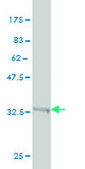 Monoclonal Anti-GGT1 antibody produced in mouse clone 1F9, purified immunoglobulin, buffered aqueous solution