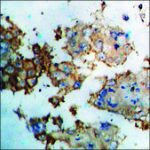 Anti-phospho-Vimentin (pSer56) antibody produced in rabbit affinity isolated antibody