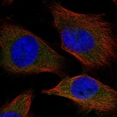 Anti-SPC25 antibody produced in rabbit Prestige Antibodies&#174; Powered by Atlas Antibodies, affinity isolated antibody, buffered aqueous glycerol solution