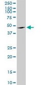 Anti-ANGPTL4 antibody produced in mouse purified immunoglobulin, buffered aqueous solution