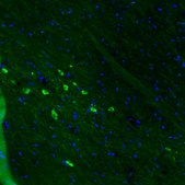 Monoclonal Anti-DDC antibody produced in mouse Prestige Antibodies&#174; Powered by Atlas Antibodies, clone CL2962, purified immunoglobulin, buffered aqueous glycerol solution