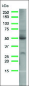 Anti-GLUT-1 antibody, Rabbit monoclonal clone SP168, recombinant, expressed in proprietary host, affinity isolated antibody