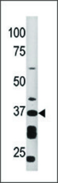 Anti-ART1 (N-term) antibody produced in rabbit IgG fraction of antiserum, buffered aqueous solution