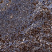 Anti-PTPN1 antibody produced in rabbit Prestige Antibodies&#174; Powered by Atlas Antibodies, affinity isolated antibody, buffered aqueous glycerol solution