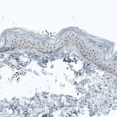 Monoclonal Anti-BCL11B antibody produced in mouse Prestige Antibodies&#174; Powered by Atlas Antibodies, clone CL6426, purified immunoglobulin, buffered aqueous glycerol solution