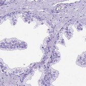 Anti-MEOX2 antibody produced in rabbit Prestige Antibodies&#174; Powered by Atlas Antibodies, affinity isolated antibody, buffered aqueous glycerol solution