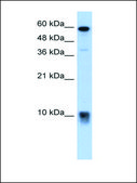 Anti-S100A3 antibody produced in rabbit IgG fraction of antiserum