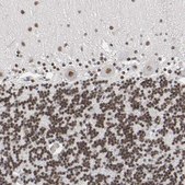 Anti-TRIM33 antibody produced in rabbit Prestige Antibodies&#174; Powered by Atlas Antibodies, affinity isolated antibody, buffered aqueous glycerol solution
