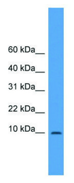Anti-IAPP (N-terminal) antibody produced in rabbit affinity isolated antibody