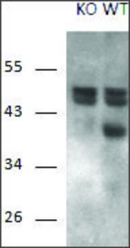 Anti-RCAN1 antibody produced in goat affinity isolated antibody, buffered aqueous solution