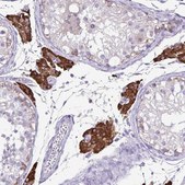 Anti-CYP17A1 antibody produced in rabbit Prestige Antibodies&#174; Powered by Atlas Antibodies, affinity isolated antibody, buffered aqueous glycerol solution
