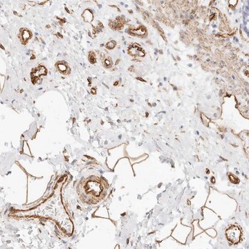 Anti-NUS1 antibody produced in rabbit Prestige Antibodies&#174; Powered by Atlas Antibodies, affinity isolated antibody, buffered aqueous glycerol solution