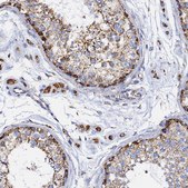 Anti-PHB2 antibody produced in rabbit Prestige Antibodies&#174; Powered by Atlas Antibodies, affinity isolated antibody, buffered aqueous glycerol solution