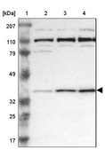ANTI-RRP7A antibody produced in rabbit Prestige Antibodies&#174; Powered by Atlas Antibodies, affinity isolated antibody, buffered aqueous glycerol solution