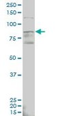 Monoclonal Anti-ALDH18A1 antibody produced in mouse clone 2B5, purified immunoglobulin, buffered aqueous solution
