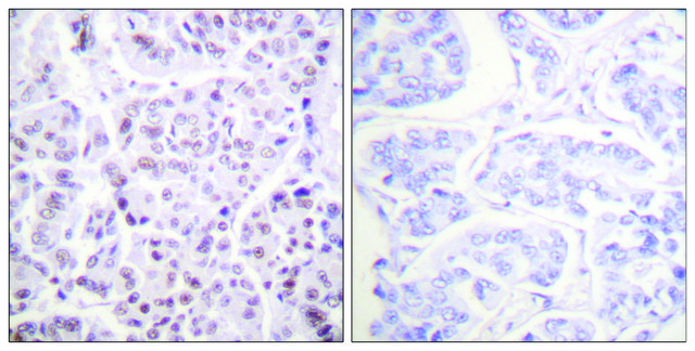 Anti-Histone H4 (Acetyl-Lys5) antibody produced in rabbit affinity isolated antibody