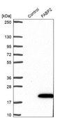 Anti-FABP2 antibody produced in rabbit Prestige Antibodies&#174; Powered by Atlas Antibodies, affinity isolated antibody, buffered aqueous glycerol solution