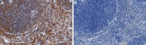 Anti-Integrin &#945;4/CD49d Antibody, clone 1C21 ZooMAb&#174; Rabbit Monoclonal recombinant, expressed in HEK 293 cells