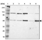ANTI-IRF9 antibody produced in rabbit Ab2, Prestige Antibodies&#174; Powered by Atlas Antibodies, affinity isolated antibody, buffered aqueous glycerol solution