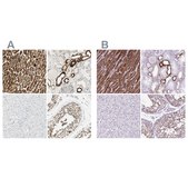 Anti-OXCT1 antibody produced in rabbit Prestige Antibodies&#174; Powered by Atlas Antibodies, affinity isolated antibody, buffered aqueous glycerol solution