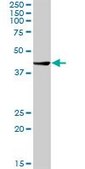 Anti-CTBS antibody produced in rabbit purified immunoglobulin, buffered aqueous solution