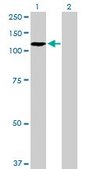 Anti-ZHX2 antibody produced in mouse purified immunoglobulin, buffered aqueous solution