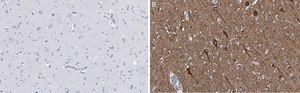 Anti-Neurofilament H Antibody, clone 5L10, ZooMAb&#174; Rabbit Monoclonal recombinant, expressed in HEK 293 cells