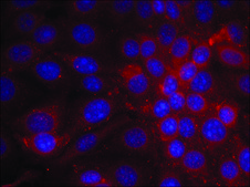 Anti-EGFR (Ab-1070) antibody produced in rabbit affinity isolated antibody