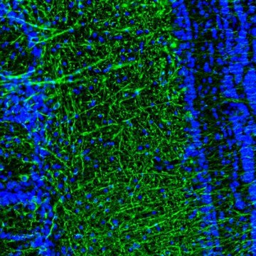 Anti-DPP6 antibody produced in rabbit Prestige Antibodies&#174; Powered by Atlas Antibodies, affinity isolated antibody, buffered aqueous glycerol solution