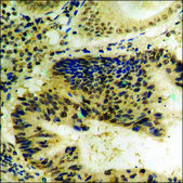 Anti-phospho-MEF2A (pThr319) antibody produced in rabbit affinity isolated antibody