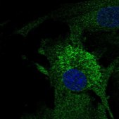 Anti-MFAP4 antibody produced in rabbit Prestige Antibodies&#174; Powered by Atlas Antibodies, affinity isolated antibody, buffered aqueous glycerol solution