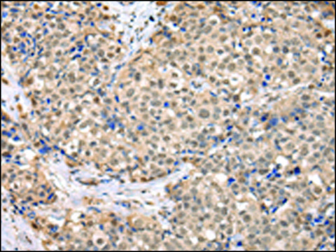 Anti-TBL1X affinity isolated antibody