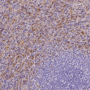 Anti-SLC40A1 antibody produced in rabbit Prestige Antibodies&#174; Powered by Atlas Antibodies, affinity isolated antibody, buffered aqueous glycerol solution