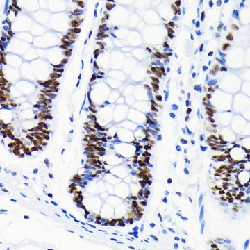 Anti-Chk2 antibody produced in rabbit