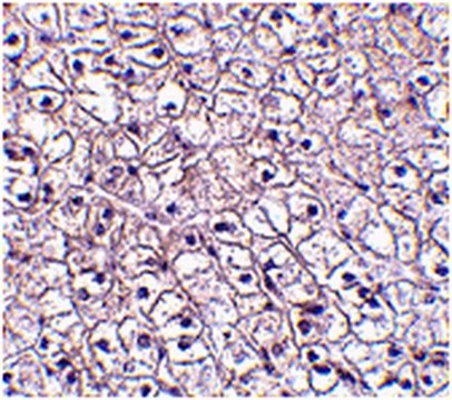 Anti-TSLP receptor Antibody from rabbit, purified by affinity chromatography