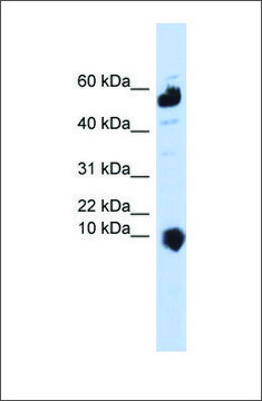 Anti-C1ORF151 antibody produced in rabbit affinity isolated antibody