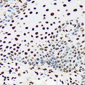 Anti-UAP56/DDX39B antibody produced in rabbit