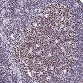 Anti-IKZF1 antibody produced in rabbit Prestige Antibodies&#174; Powered by Atlas Antibodies, affinity isolated antibody, buffered aqueous glycerol solution